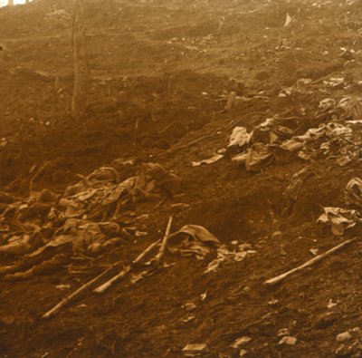 Efter attacken, Les Éparges, norra Frankrike, 1915. av Unbekannt
