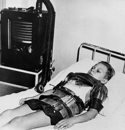 Elva år gammal pojke i en järnlunga, Beaujon Hospital, Paris, c1947-1951 av Unbekannt