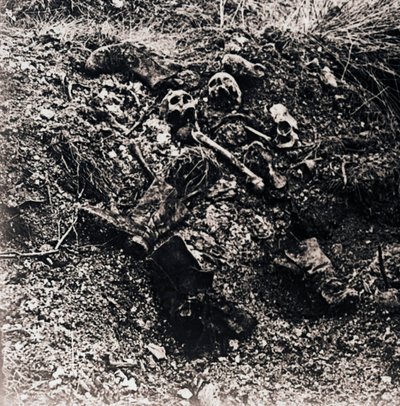 Mänskliga kvarlevor, c1914-c1918 av Unbekannt