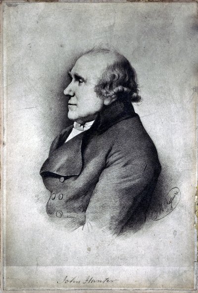 John Hunter, brittisk kirurg och anatom, ca 1770-talet av Unbekannt