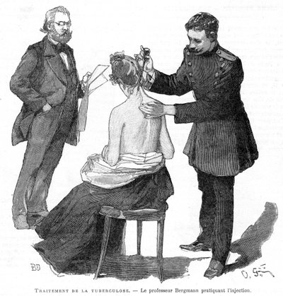 Professor Bergmann injicerar en tuberkulospatient, 1891 av Unbekannt