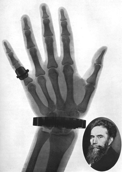 Röntgenfotografi av en hand, 1926 av Unbekannt