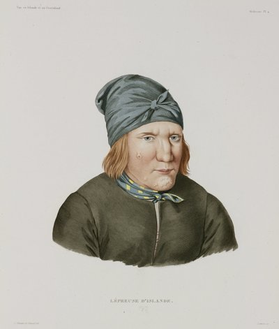 Sjukdomar, spetälska Spetälska, Island, tidigt 1800-tal av Unbekannt