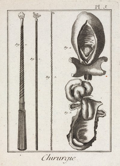 Utrustning, tidigmoderna kirurgiska instrument och diagram över kroppsdelar av Unbekannt