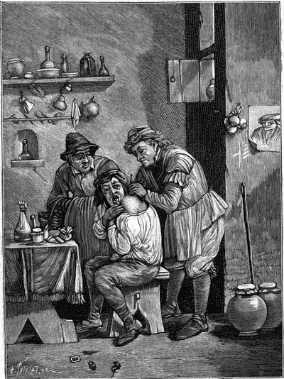 En charlatankirurg på 1700-talet undersöker en axelskada. (Ur en gravering av tiden). Gravyr i "" La Nature: revue des sciences et de leurs applications aux arts et a l