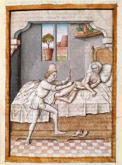 En läkare behandlar en miniatyrpatient från en tysk översättning av fablerna om "Kalila (Calila) och Dimna" av Bidpai. (ms. 1389, fol. 23) omkring 1480 Chantilly, museum Conde av Unknown artist