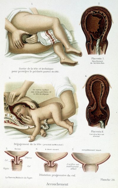 Förlossning - vetenskaplig styrelse, sent 1800-tal av Unknown artist
