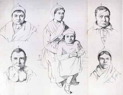 Överväganden om orsakerna till endemisk kretinism av Morel. av Unknown artist