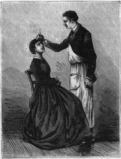 Hypnosfenomen: Hypnotism produceras genom att fästa en pennhållare mellan ögonen. Gravyr från 1881. av Unknown artist