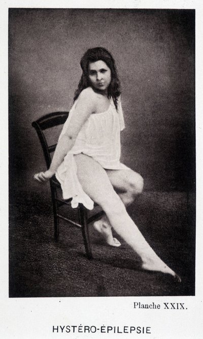 Hystero Epilepsie - Contracture in "" Photographic iconography of the Salpétrière: service of Mr. Charcot" av Paul Regnard och Bourneville av Unknown artist