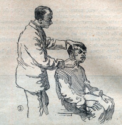 Rättslig antropometri eller bertillonnage, metod av Alphonse Bertillon (1853-1914): mätning av örat - gravyr i "La Science francaise"" av Unknown artist