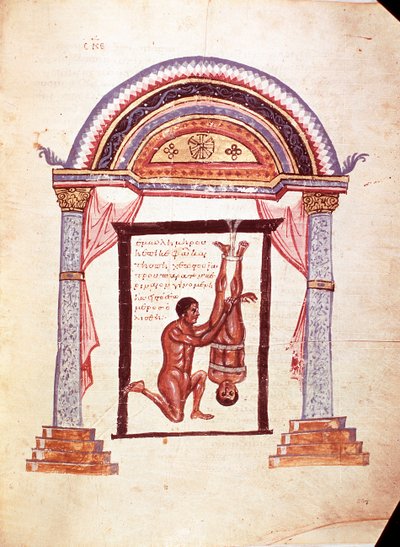 Medicin: minskning av ett ur led knä, patienten hängs av vid fötterna (manuskript av Unknown artist