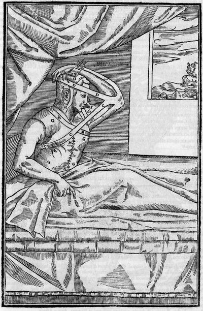 Näsoperation: Rekonstruktionskirurgi på näsan i ”De curtorum chirurgia per insitionem””. Venedig av Unknown artist