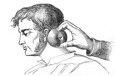 Saignee lokaler - applicering av iglar med ett äpple - gravyr i "La Santo Universelle - Medicinsk guide för familjer"" 1852 av Unknown artist