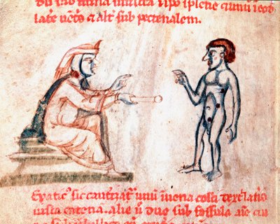 Läkaren bränner patienten på smärtsamma områden med heta strykjärn Miniatyr från manuskriptet "De Medicina cauteriorum secundum Brunum, Rugerius et Rolthe" 1200-talets Paris, B.N. av Unknown artist