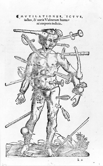 Alla typer av traumatiska krigsskador. 1500-talet av Unknown artist