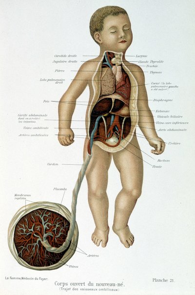 Medicin: nyfödd (flådd i bysten). av Unknown artist