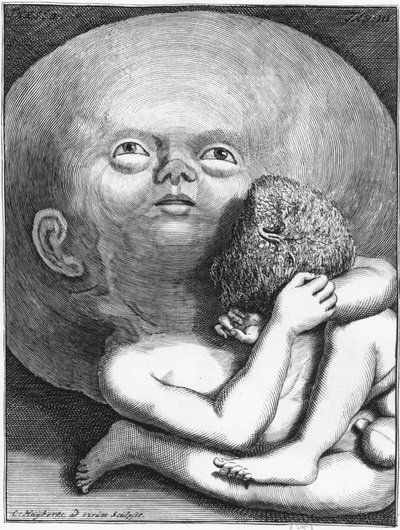 Monster: Child hydrocephalus anthropology - grave., a.n.d., sent 1700-tal av Unknown artist