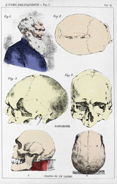 Studie om morfologin hos en brottslig skalle av den italienska kriminologen av Unknown artist