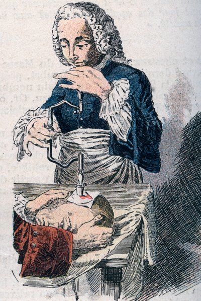 Trepanationen. 1700-talstryck. av Unknown artist