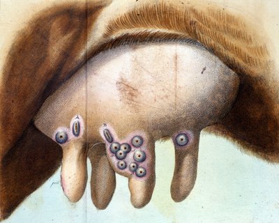 Kobröstet användes för att inokulera smittkoppsvaccinet av Luigi Sacco (1769-1836) i januari 1801. Medicinsk platta från "" Vaccination Treat" av Luigi Sacco, Milano av Unknown artist