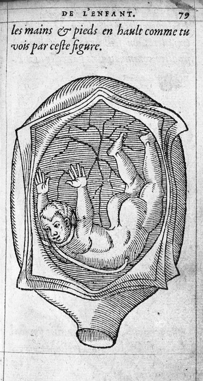 Fostrets position i livmodern under graviditeten. Gravyr från "" De la generation des enfants"" av den franska läkaren och kirurgen Ambroise Pare (1509-1590) 1500-talet av Unknown artist