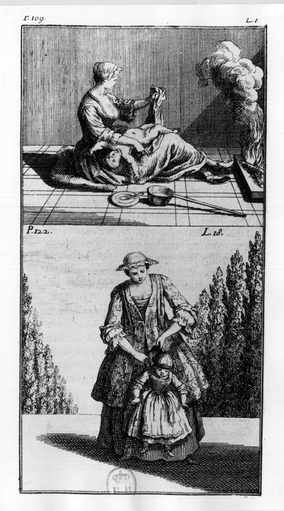 Behandlingar för barn - i ”” Ortopedi eller konsten att korrigera och korrigera kroppens svårigheter””, av M. Audry, rådman hos Kungl. av Unknown artist