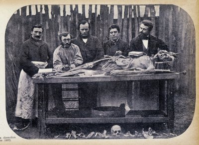 Dissektion, v.1865. av Unknown photographer