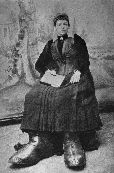 Monsters, Bertha med stora fötter. Fotografi, sent 1800-tal, Paris. Coll. Selva. av Unknown photographer