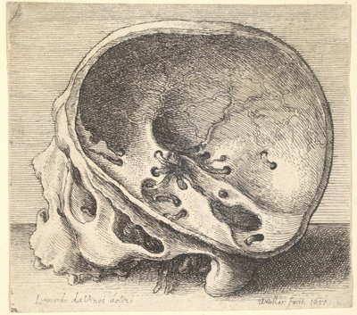 Sektionerad skalle i profil till vänster med vänster sida av kraniet borttagen, 1651. av Wenceslaus Hollar
