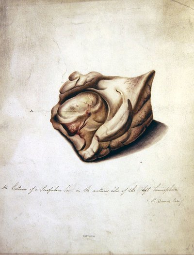 Study of the Brain II, c.1850 (akvarell på papper) av William Lover