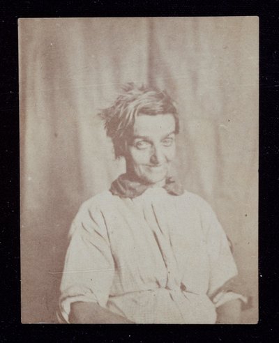 Psykiatri Porträtt av en patient, Surrey County Asylum, ca 1852 av John Pardon