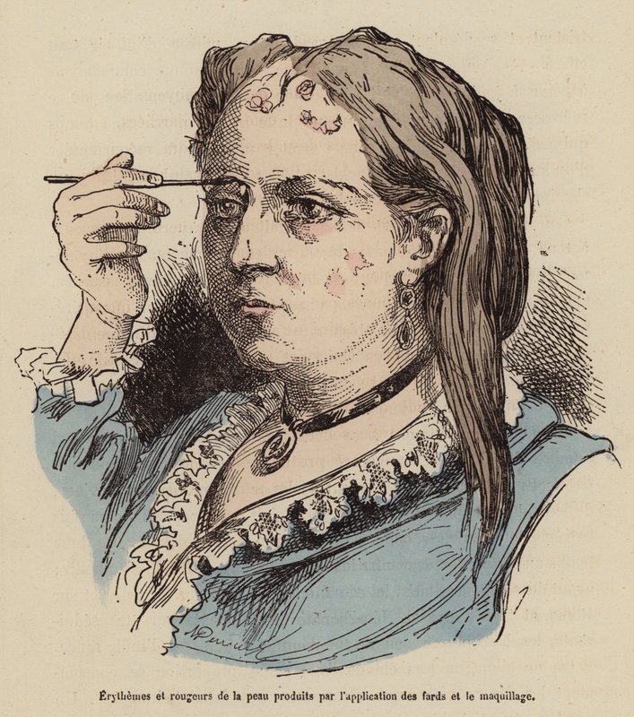 Kvinna med hudutslag och rodnad orsakade av smink (färggravyr) av (after) French School