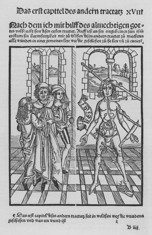 The Book of Cirurgia av Hieronymus Brunschwig (litho) av (after) German School