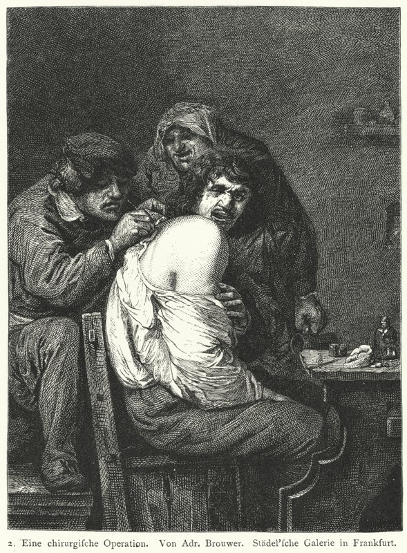 Ryggoperationen av Adriaen (after) Brouwer