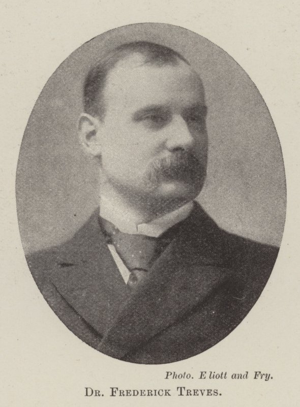 Dr Frederick Treves av English Photographer