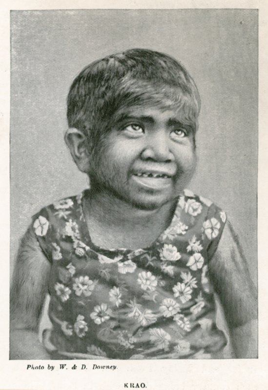 Krao, The Missing Link, utställd på Aquarium, Westminster, London, 1887 av English Photographer