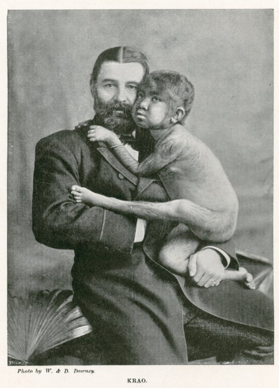Krao, The Missing Link, utställd på Aquarium, Westminster, London, 1887 av English Photographer
