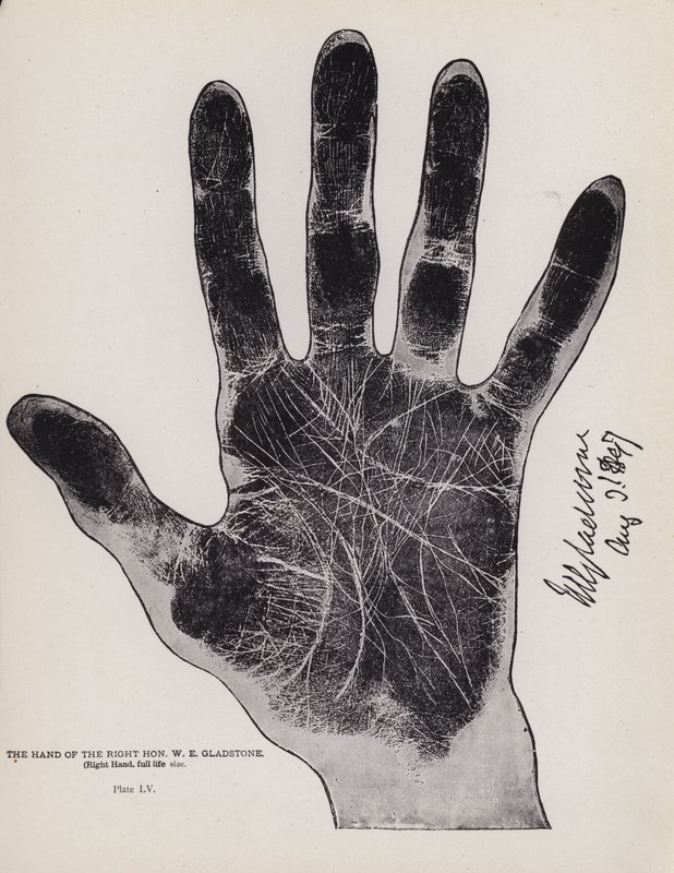 Right Hon W E Gladstones hand (svartvitt foto) av English Photographer