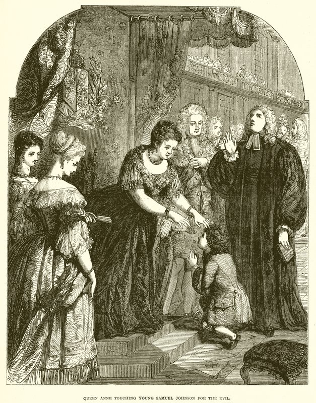 Drottning Anne berör unge Samuel Johnson för ondskan av English School