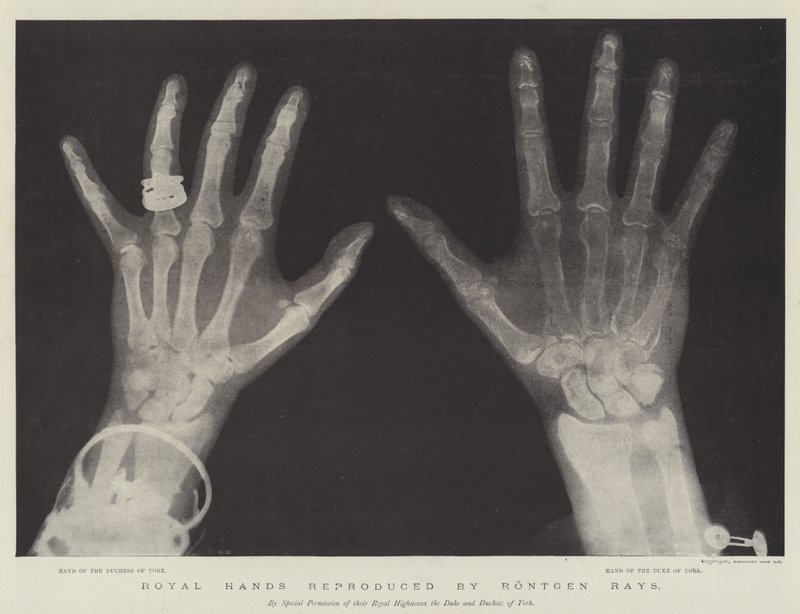 Royal Hands reproducerad av Rontgen Rays (gravyr) av English School