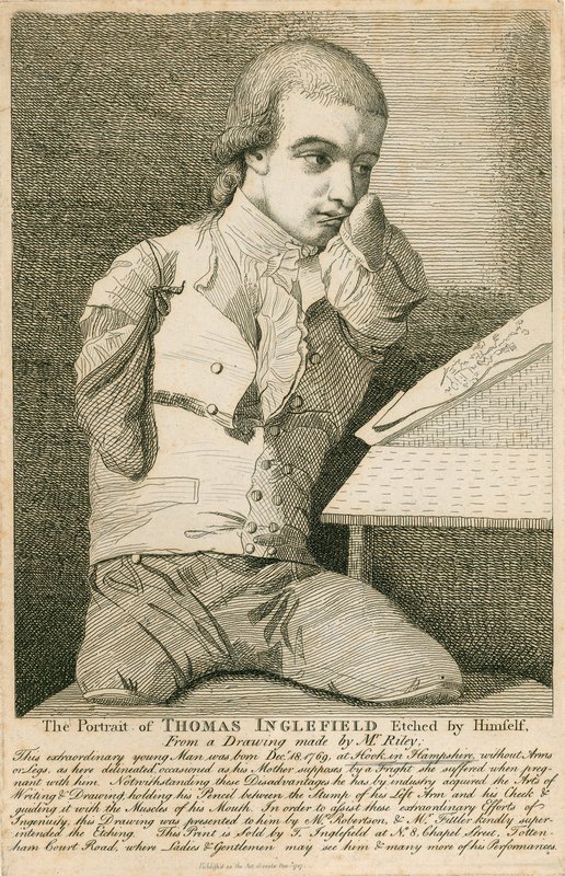 Thomas Inglefield, född 18 december 1769 i Hook, Hampshire, utan armar eller ben av English School