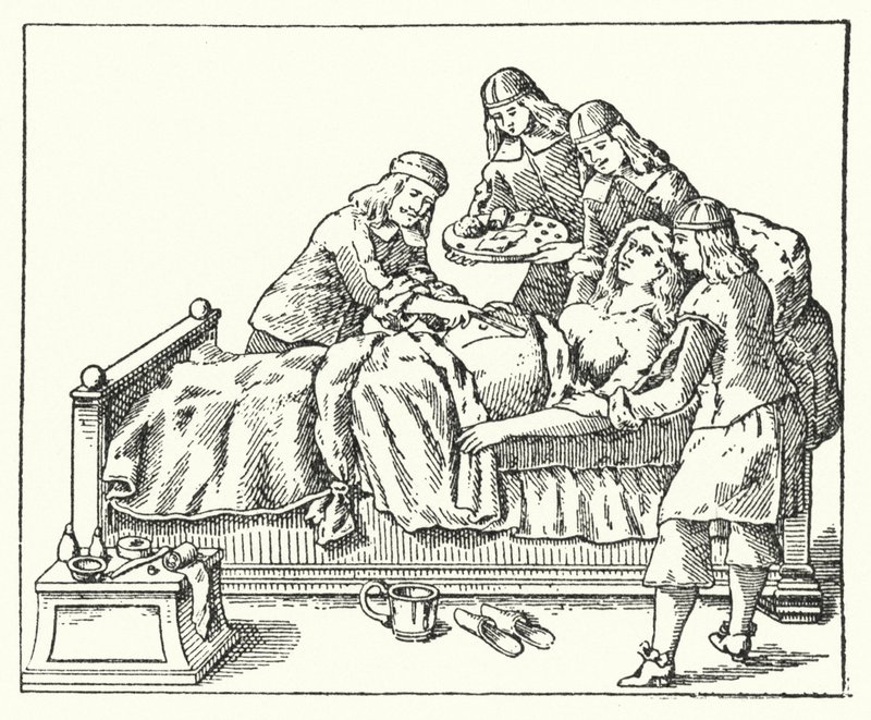 Ett kejsarsnitt på 1600-talet (gravyr) av European School