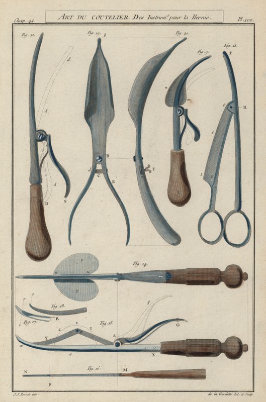 Instrument för bråckkirurgi (färgad gravyr) av European School