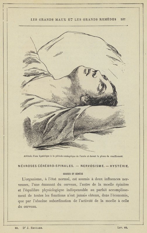En hysterikers attityd under den kataleptiska perioden av tillträdet och under fasen av korsfästelsen (färg litho) av French School