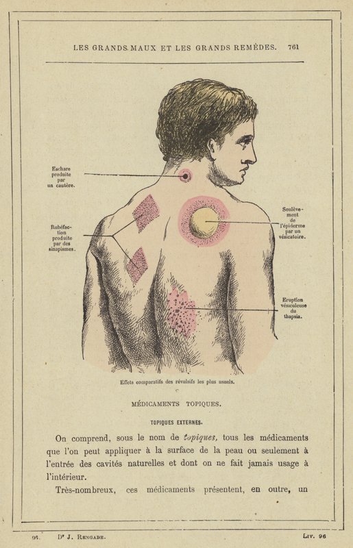 Jämförande effekter av de vanligaste repellenterna (färg litho) av French School