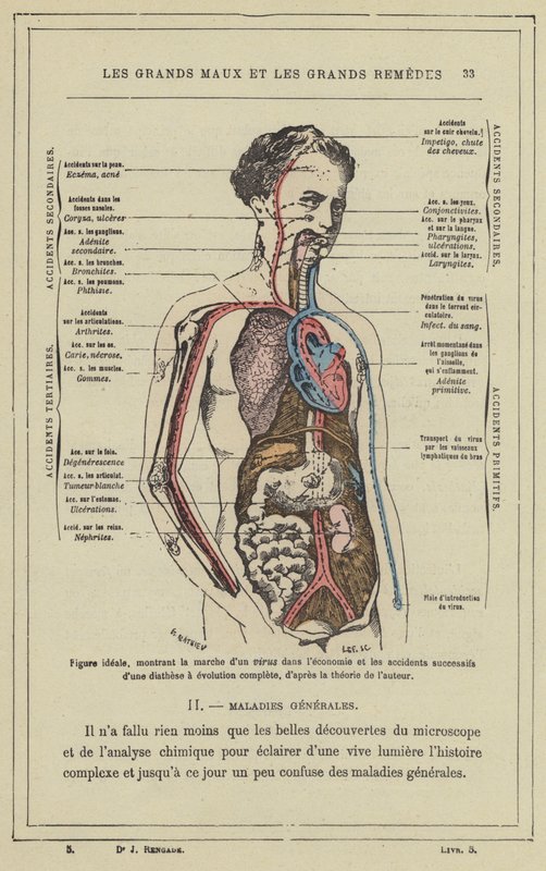 Idealfigur, som visar framstegen för ett virus i ekonomin och de successiva olyckorna i en diates med fullständig evolution, enligt författarens teori (color litho) av French School