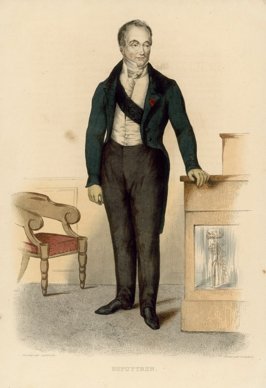 Guillaume Dupuytren (färgad gravyr) av French School