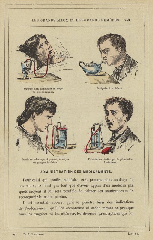 Förtäring av ett läkemedel med hjälp av matröret, rökning med tekanna, balsamsyra och gasinandning, med hjälp av inhalatorförgasaren, Reaktiv sprutning med reaktionssprutan (färg litho) av French School
