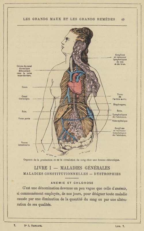 Organ för blodproduktion och cirkulation hos en klorotisk kvinna (färg litho) av French School